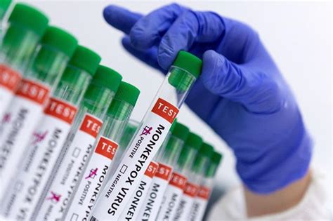 British Columbia: Health measures enough vs mpox .
